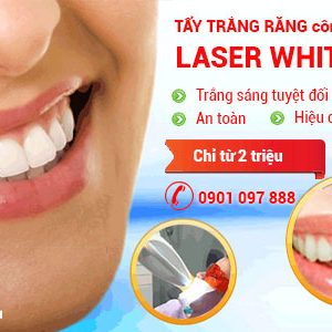 Tẩy trắng răng bằng công nghệ Laser White.